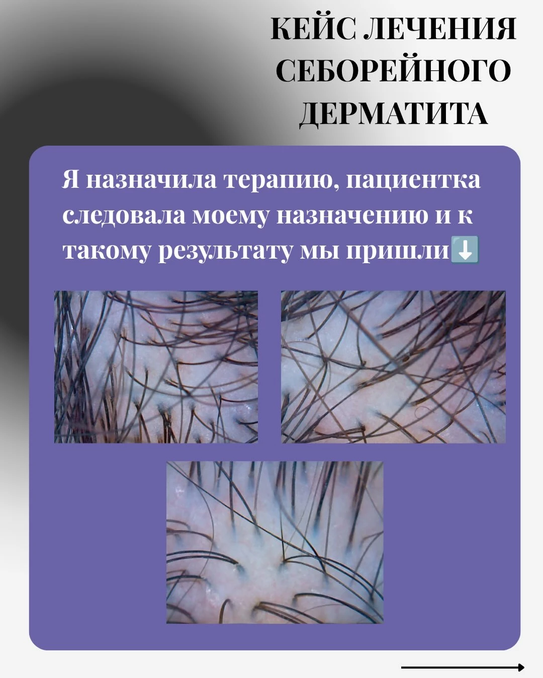 Скалпът под увеличение. След. Два оригинални слайда от една публикация — без промяна на изображенията.